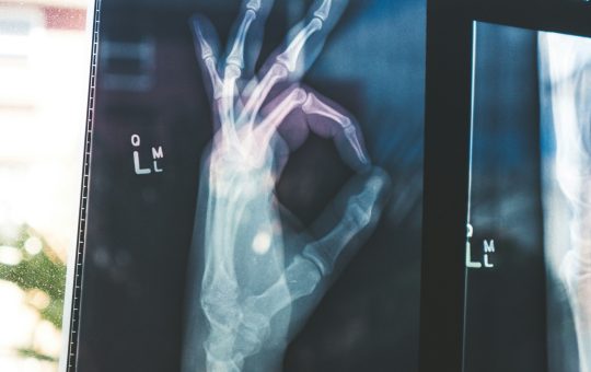 Google's open MedGemma AI models could transform healthcare